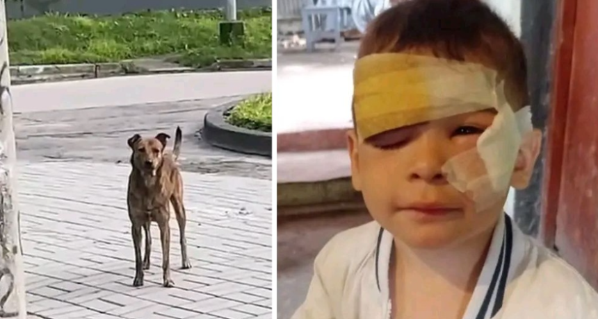 Un perro mordi&oacute; a un ni&ntilde;o de 3 a&ntilde;os y le provoc&oacute; graves heridas en el rostro