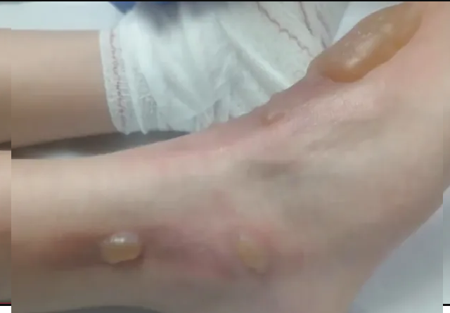 Horror: un niño de 11 años fue torturado por su amigo de 12 años