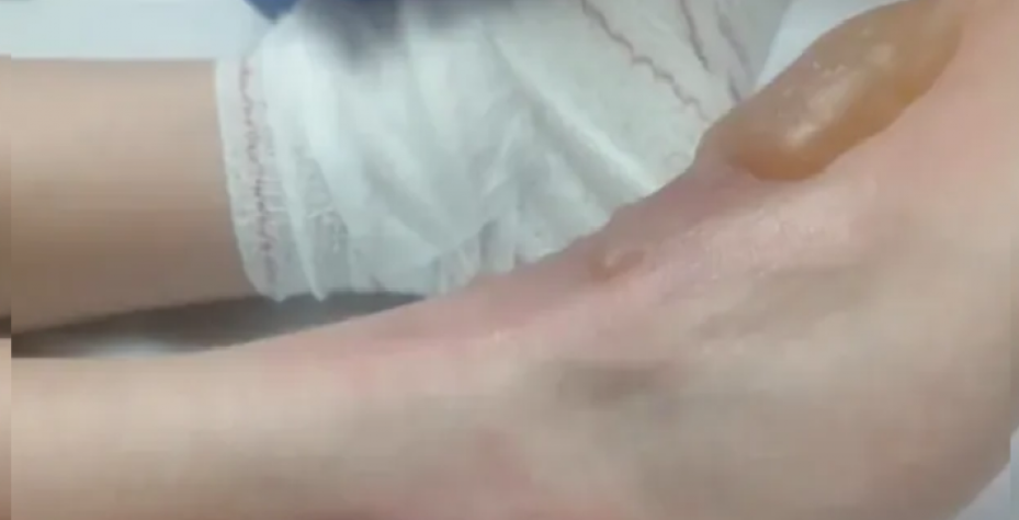 Horror: un niño de 11 años fue torturado por su amigo de 12 años