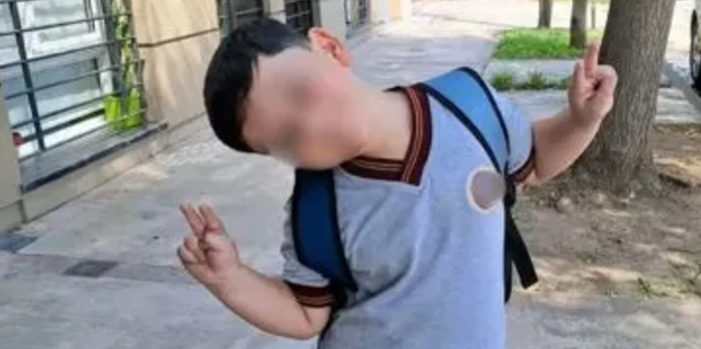 Bastián fue operado por tercera vez: tenía múltiples fracturas de cráneo