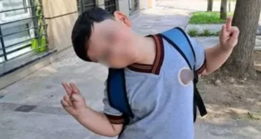 Bastián fue operado por tercera vez: tenía múltiples fracturas de cráneo