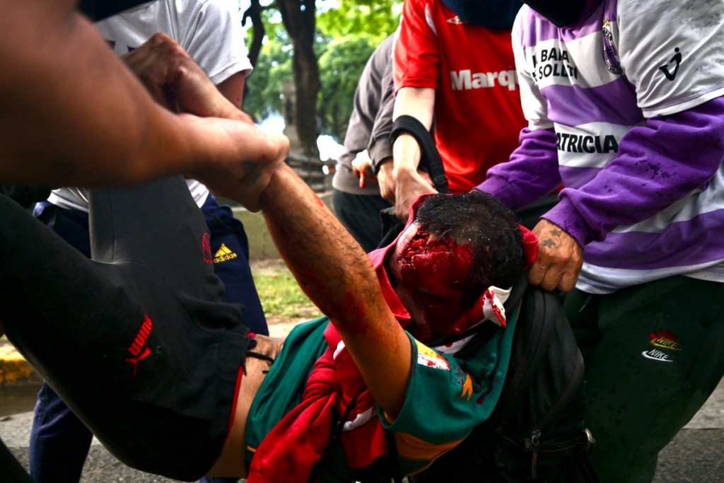 Marcha de los jubilados derivó en violencia y un herido gravemente 