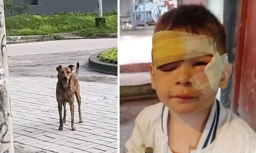 Un perro mordi&oacute; a un ni&ntilde;o de 3 a&ntilde;os y le provoc&oacute; graves heridas en el rostro