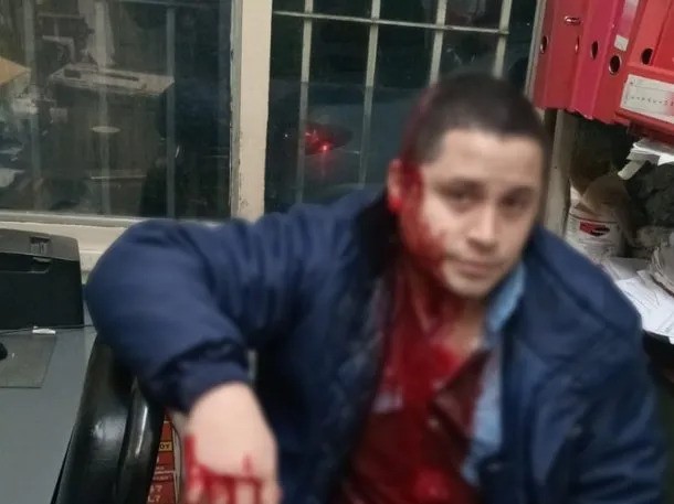 Paro de colectivo en el AMBA luego de que un colectivero fue apuñalado por un delincuente 