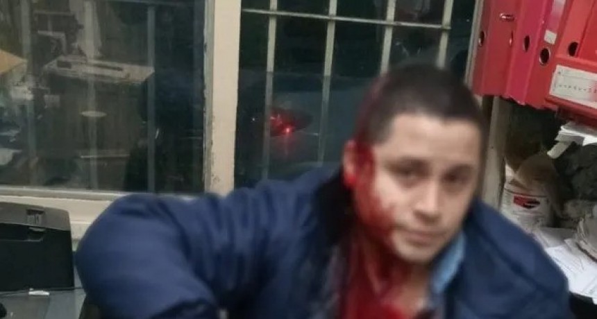 Paro de colectivo en el AMBA tras el ataque feroz a un colectivero