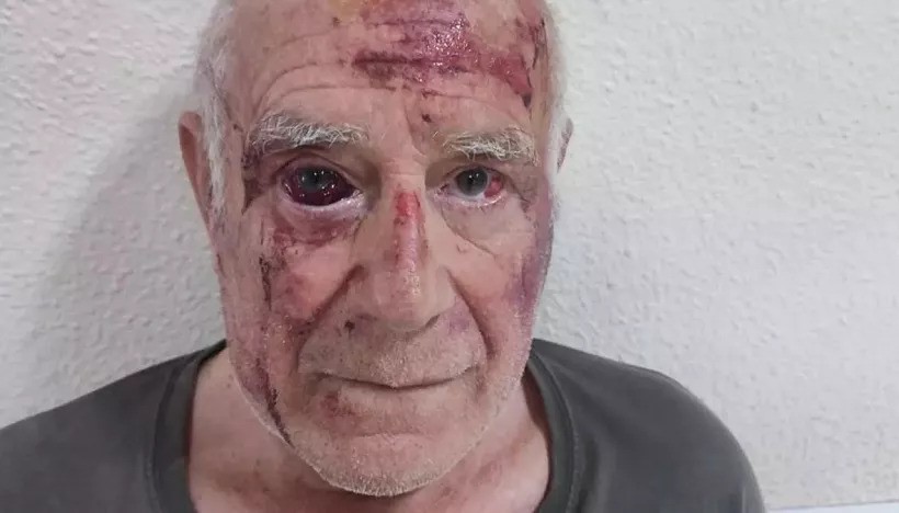 Un hombre fue brutalmente golpeado por un macabro juego viral
