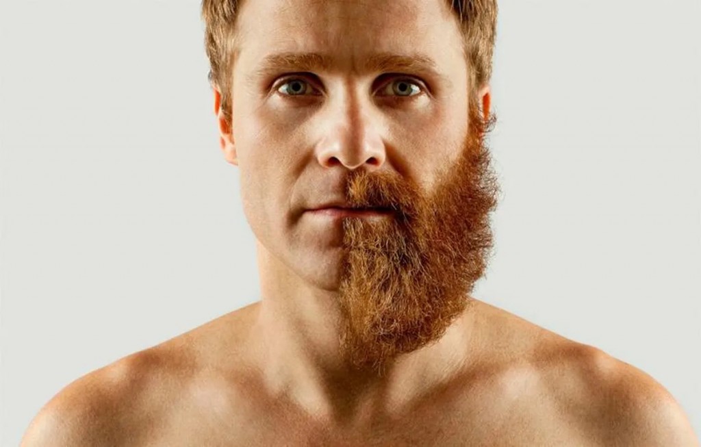 Qué es la pogonofobia que aleja a las personas de las barbas