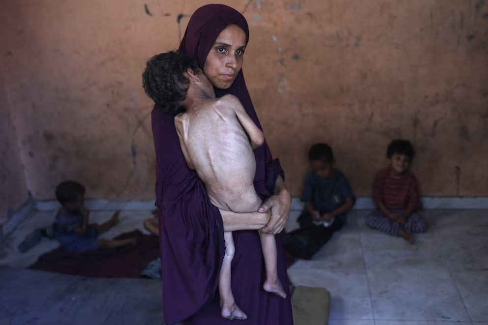 Hambruna en gaza: “Cada semana los números son mayores”