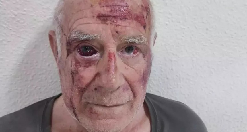 Un hombre fue brutalmente golpeado por un macabro juego viral