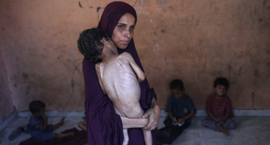 Hambruna en gaza: “Cada semana los números son mayores”