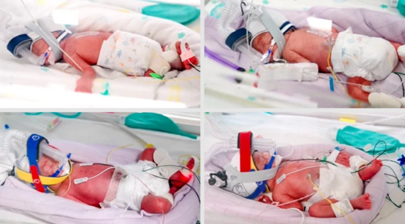 Extraordinario: una mujer dio a luz a cuatrillizas id&eacute;nticas concebidas de forma natural