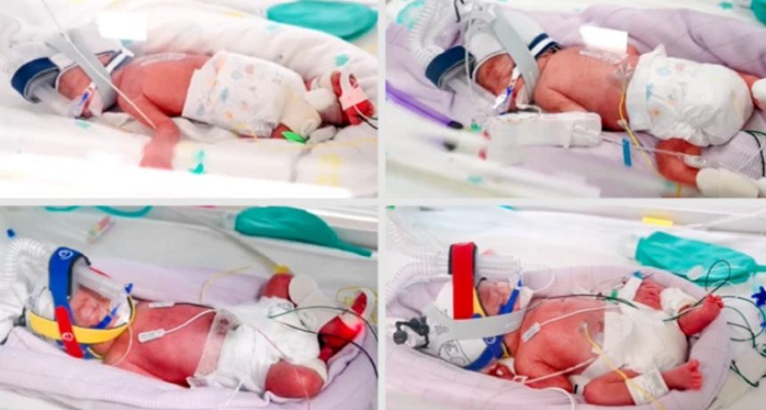 Extraordinario: una mujer dio a luz a cuatrillizas id&eacute;nticas concebidas de forma natural