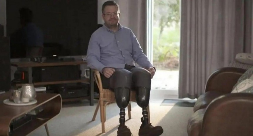 Londres: médico cirujano se hizo amputar las piernas para cobrar un seguro