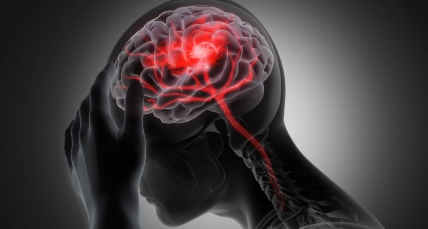 Día Mundial del ACV: cuáles son las 5 señales de alerta