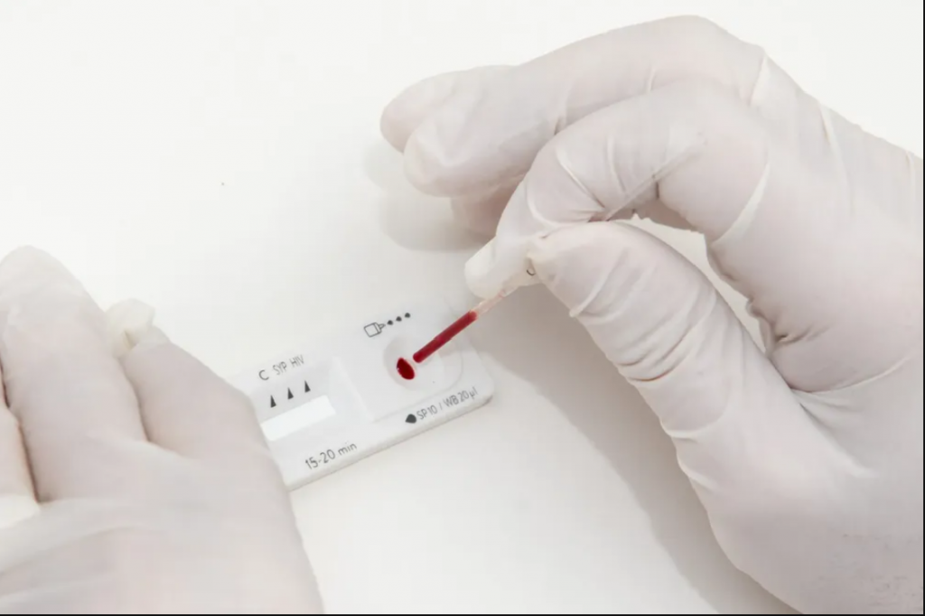 En el Día Mundial de la Lucha Contra el Sida, el Municipio realizará una jornada de testeo rápido y gratuito para detectar el VIH