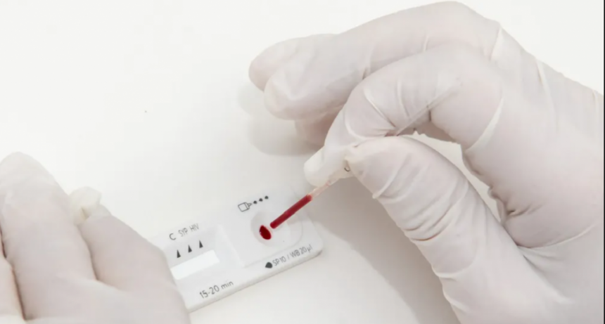 En el Día Mundial de la Lucha Contra el Sida, el Municipio realizará una jornada de testeo rápido y gratuito para detectar el VIH