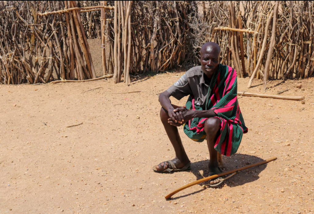Micetoma: la enfermedad que ataca los huesos en el norte de Kenia